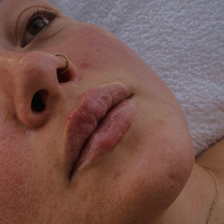 chin-1